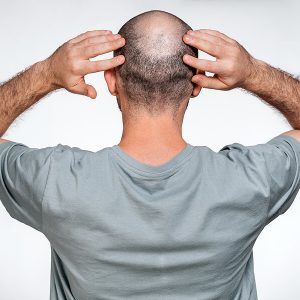 bigstock-A-Man-Holds-His-Hands-Over-His-379543285